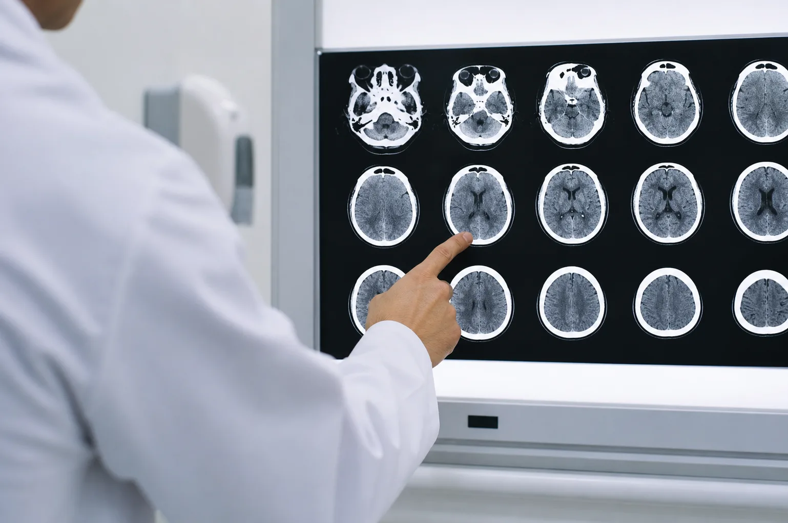Doctor reviewing a brain CT scan that appears normal on a clinic display